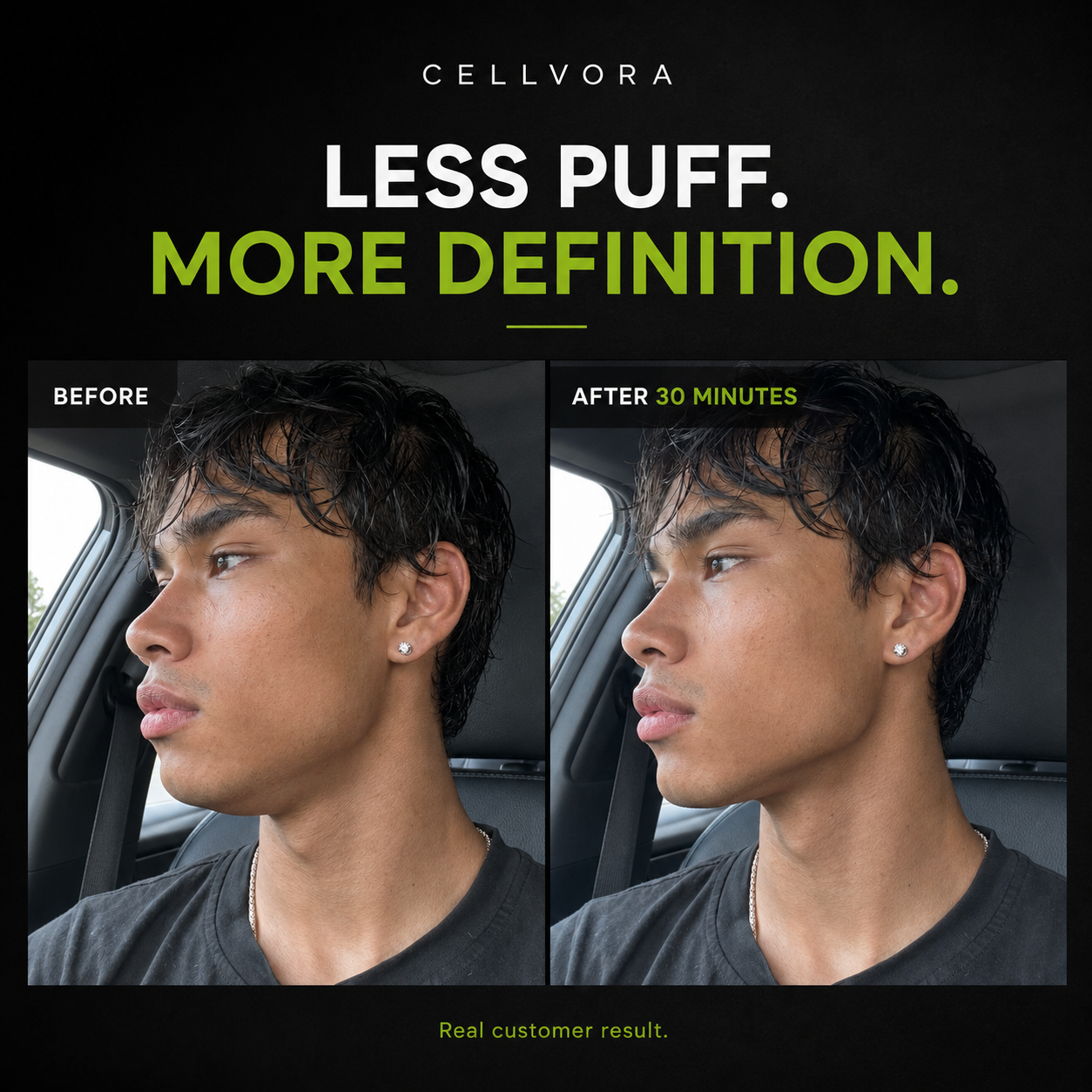 CACTOX V-LIFTING MEWING BAND